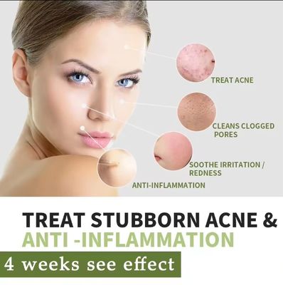Organic Herbal Anti Acne Remover Pimple Treatment Repair Scar Cream