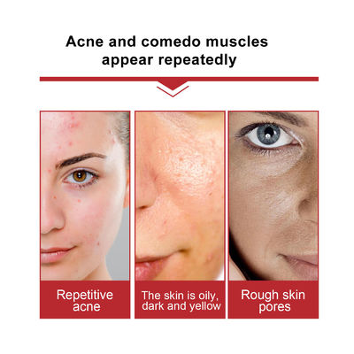 Moisturizing Repairing Face Serum Soothing Face Serum Complex Fruit Acid Essence