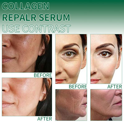 Collagen Face Serum Moisturizing Soothing Skin Firming Serum Transparent Essence
