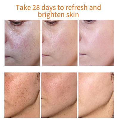 OEM Facial Moisturizing Cream Brightening Anti Wrinkle Spot Removing Cream