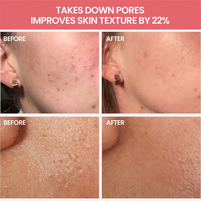 Witch Hazel Face Toner Pore Minimizer Calming Skin Treatment Product Skin Toner