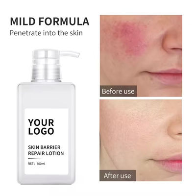 Glycyrrhiza Glabra Face Lotion Anti Acne Barrier Repair Lotion Soothing Sensitive