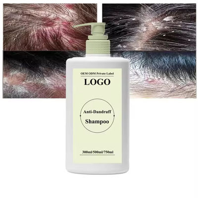 Oil Control Anti Dandruff Anti Itchin Shampoo Deep Cleansing Hair Shampoo