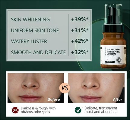 Whitening Face Lotion Alpha Arbutin Dark Spot Face Cream Lotion Skincare Facial Lotion