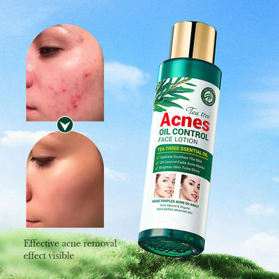 OEM ODM Face Lotion Natural Organic Tea Tree Moisturizer Aging Skin Treatments