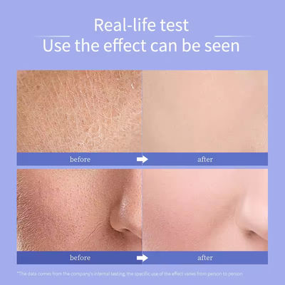 ODM Hydrating Face Mask Whitening Repair Brightening Mask Hydrating Shrinking Pores