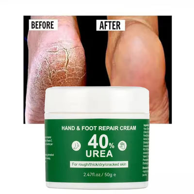 OEM Vitamin E Hand Foot Care Anti Drying Vaseline Urea Cream Foot Repair