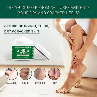 OEM Vitamin E Hand Foot Care Anti Drying Vaseline Urea Cream Foot Repair