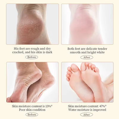 Chamomile Extract Hand Crack Cream Dryness Crackness  Feet Moisturizing Cream