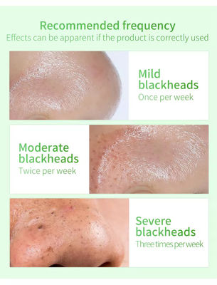 Blackhead Remover Face Serum Natural Organic Anti Aging Repair Skin Care Serum