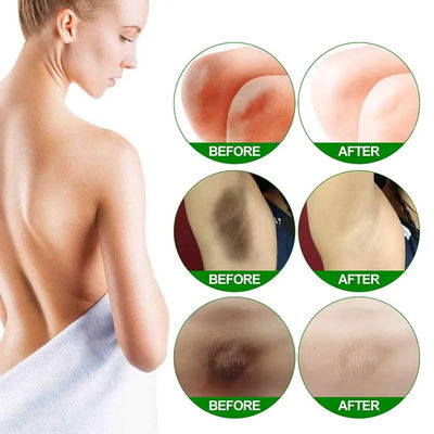 Body Whitening Cream Bleaching Serum Remove Melanin Pigmentation Brighten Inner Thigh Skin Moisturizing Cream