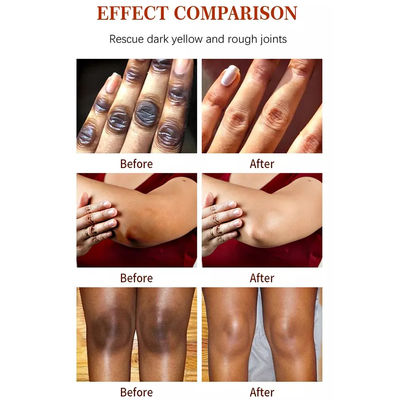 Face Black Freckle Acne Fade Dark Spot Removing Corrector Whitening Cream