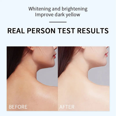 Bodycare Whitening Body Lotion Remove Black Spots And Dark Yellow Skin Care Brightening Hydrating Glutathion