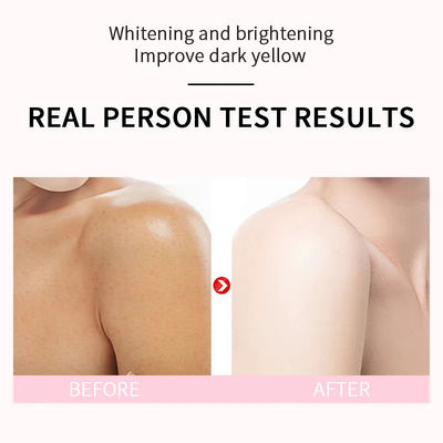 Skin Care Deep Clean Body Lotion Essens Hydrating Nourish Whitening Hyperpigmentation Treatment Skin Care