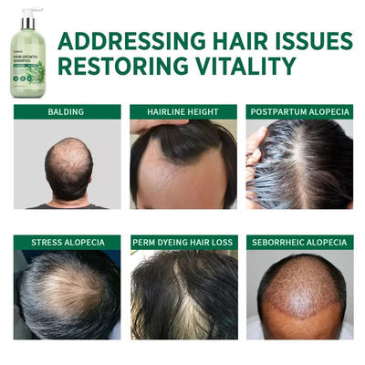 Hydrates And Nourishes Hair And Scalp Long Lasting Fragrance Simply Grow With Activation Shampoo De Rosemary