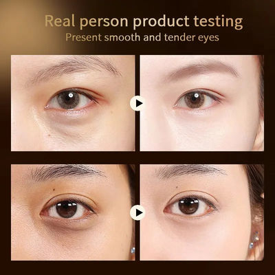 Firming And Moisturizing Reducing Fine Lines Dark Circles And Bag Removal Eye Dark Circles Remove Cream