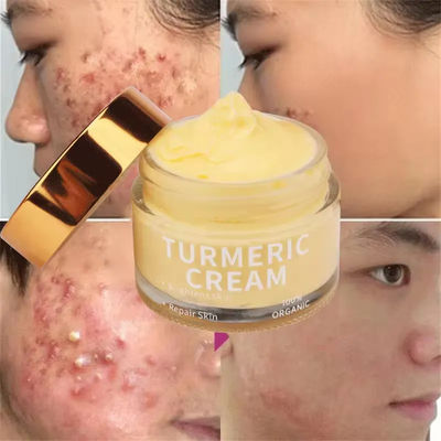 Organic Skin Care Acne Wrinkle Dark Spot Moisturizer Bleaching Turmeric Face Cream