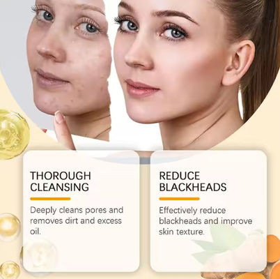 OEM Private Label Kojic Acid Clean and Clear Skin Brightening Foaming Face Wash Turmeric Foam Cleanser for Dark Spots Acne