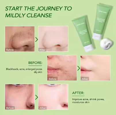 Facial Cleanser for Men and Women Deep Cleansing Shrinking Pores Moisturizing and Moisturizing Face Wash
