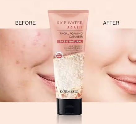 Face Wash Facial Cleanser Whitening Face Wash With Rice Extract for Oily Dry Skin