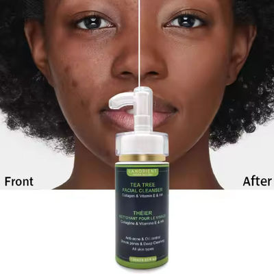 OEM Private Label Oil Free Facial Cleanser Anti Acne Organic Amino Acid Face Wash for All Skin