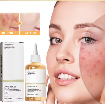 Private Label 7% Face Toner Glycolic Acid Toning Solution Dry/Oily/Sensitive Skin Care Face Exfoliator Spray for Adults