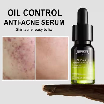 Customized Logo Face Serum 14 Day Quick Acne Solution Essence 10ml