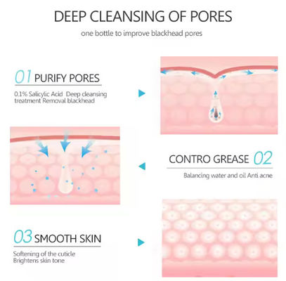 Anti Acne Skincare Facial Mud Ultra Mask Cleansing Salicylic Acid Rejuven Face Clay Mask