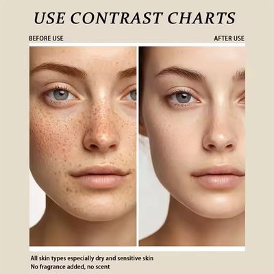 Skin Care Serum Dermatologist Tested Hypoallergenic Vegan Facial Oil Avocado Apricot Jojoba Oil