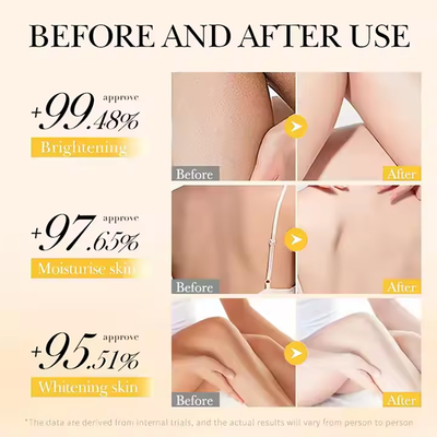 Turmeric Vitamin C Whitening Body Lotion Anti Acne Hydrating Brightening Body Lotion for Women Vitamin C Retinol Body Lotion